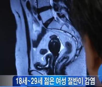▲ 사진 = MBC 뉴스 캡쳐
