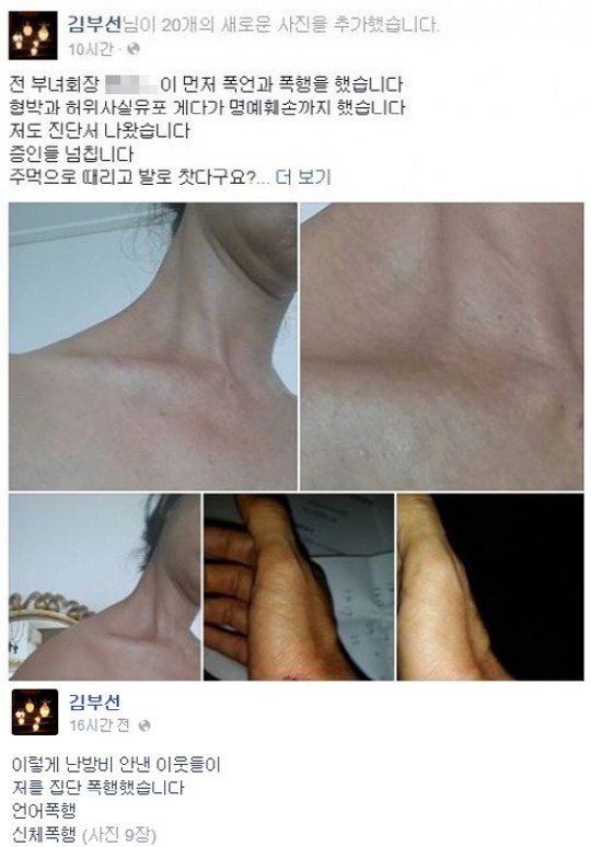 ▲ 김부선 폭행 혐의 부인(사진 김부선 페이스북)