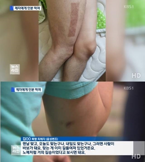 ▲ 인분교수 징역 12년 피해자 사연 (사진: KBS1 '뉴스라인' 방송 캡처)